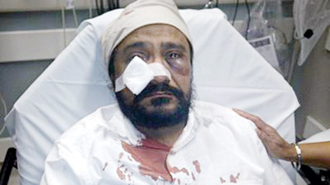 CHICAGO: This undated photo provided by Kanwar Singh, shows his father, Inderjit Mukker, after he was beaten in a September 2015 road rage incident with a Chicago-area teenager in which the teen called the 53-year-old Sikh taxi driver “Bin Laden” and repeatedly hit him in the face.