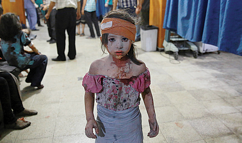 This file photo taken on August 22, 2015 shows a wounded Syrian girl looking on at a makeshift hospital in the rebel-held area of Douma, east of the capital Damascus, following shelling and air raids by Syrian government forces. —AFP