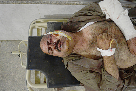 PESHAWAR: A Pakistani man who was injured in a bomb blast arrives at a local hospital. —AP