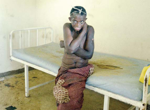 MELEN, Gabon: A woman patient tries to cover her chest as she sits on a bed in a ravaged room in Gabon’s sole psychiatric hospital, the National Centre for Mental Health in Melen (CNSM). — AFP photos