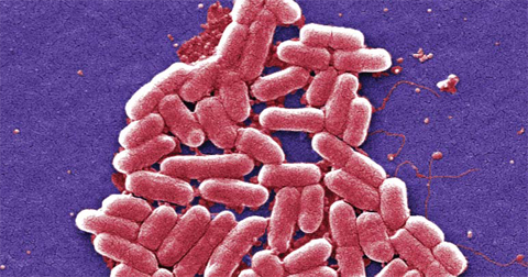 NEW YORK: This 2006 colorized scanning electron micrograph image made available by the Centers for Disease Control and Prevention shows the O157:H7 strain of the E. coli bacteria. Bacteria with a special type of resistance to antibiotics have been found for a second time in the US, increasing worries that the country will soon see a superbug that cannot be treated with known medications. This case, first reported in a medical journal Monday, occurred a year earlier in New York. — AP