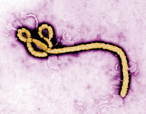 KINSHASA: In this undated colorized transmission electron micrograph file image made available by the CDC shows an Ebola virus virion. —AP