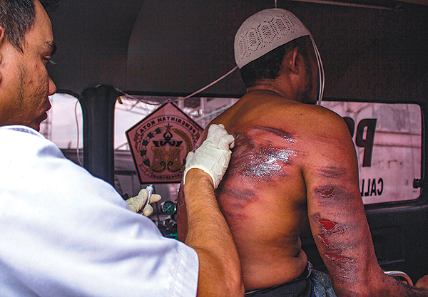 ACEH, Indonesia: A Sharia law enforcement medical official checks the injuries of a man who was whipped in Lhokseumawe.-AFP