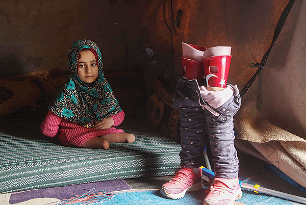 SERJILLA, Syria: Syrian Maya Merhi poses for a picture next to her prosthetic legs that are decorated with the Turkish flag inside a tent at this Internally Displaced Persons (IDP) camp in northwestern Syria yesterday