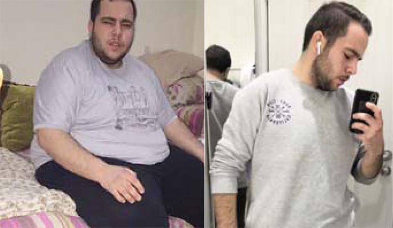 Ali Al-Moqadem - Before and  After