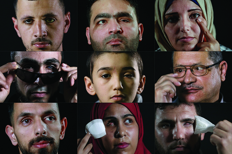 This combination of pictures created on June 11, 2020 shows Palestinians blinded in one eye - (op left to right) Mohammed Burqan, Muath Amarneh and Jacqueline Shahada; (middle left to right) Ahmed Al-Louth, Malek Issa and Nafez Al-Damiri; (bottom left to right) Rifaat Barham, Mai Abu Rawda and Sami Marsan. — AFP