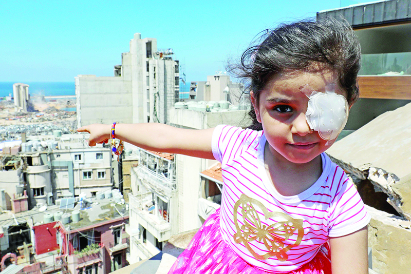 TOPSHOT - Sama al-Hamad, 6-year-old Syrian girl who lost her left eye in the August 4 cataclysmic explosion, points at the blast site from the roof of her damaged house in Beirut's Mar Mikhael district on August 16, 2020. - The powerful August 4 explosion that killed 177 people and devastated swathes of the Lebanese capital also left thousands wounded, mostly from flying shards of glass. At least 400 people suffered ocular injuries, more than 50 required surgery, and at least 15 were permanently blinded in one eye, according to data compiled by major hospitals in and around Beirut. (Photo by ANWAR AMRO / AFP)