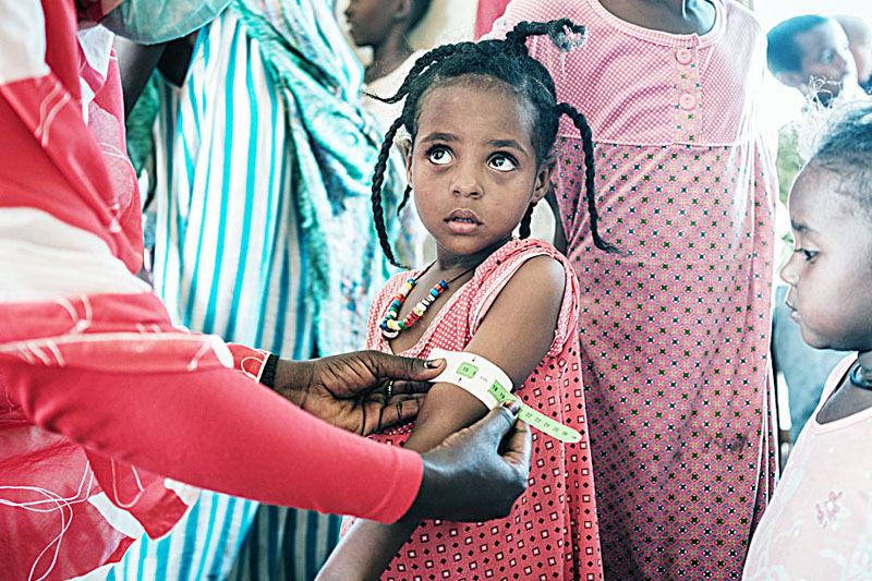 A four-year-old Ethiopian girl who fled the Tigray conflict as a refugee is measured at a malnutrition center at Village Eight transit centre near the Ethiopian border in Gedaref, eastern Sudan, on December 2, 2020. (Photo by Yasuyoshi CHIBA / AFP)