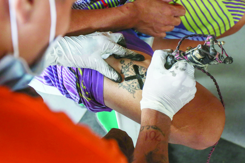 In this photo taken on November 23, 2020, an artist removes a tattoo of an inmate at the New Bilibid Prison in Manila. - Heavily-tattooed Philippine inmates wince in pain as fellow prisoners use improvised tattooing machines to cover up symbols identifying their gang affiliation in a skin-deep effort to reduce jail violence. (Photo by Jam STA ROSA / AFP) / TO GO WITH AFP STORY: Philippines prison tattoo, FOCUS by Ron LOPEZ