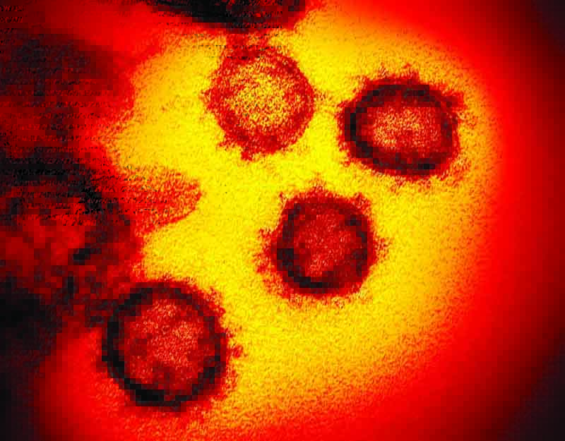 This handout illustration image obtained February 27, 2020 courtesy of the National Institutes of Health shows a transmission electron microscopic image  that shows SARS-CoV-2óalso known as 2019-nCoV, the virus that causes COVID-19, isolated from a patient in the US, emerging from the surface of cells cultured in the lab. - President Donald Trump has played down fears of a major coronavirus outbreak in the United States, even as infections ricochet around the world, prompting a ban on pilgrims to Saudi Arabia. China is no longer the only breeding ground for the deadly virus as countries fret over possible contagion coming from other hotbeds of infection, including Iran, South Korea and Italy. There are now more daily cases being recorded outside China than inside the country, where the virus first emerged in December, according to the World Health Organization. (Photo by Handout / National Institutes of Health / AFP)