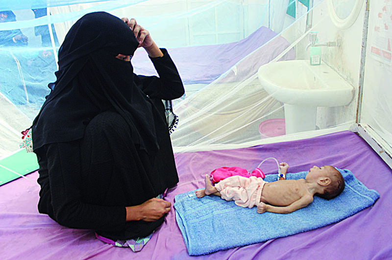 (FILES) In this file photo taken on January 20, 2021, a Yemeni mother sits with her malnourished child during treatment at a medical centre in Yemen's northern Hajjah province. - About 400,000 children under the age of five are in danger of dying of acute malnutrition in war-torn and impoverished Yemen, UN agencies warned. (Photo by ESSA AHMED / AFP)