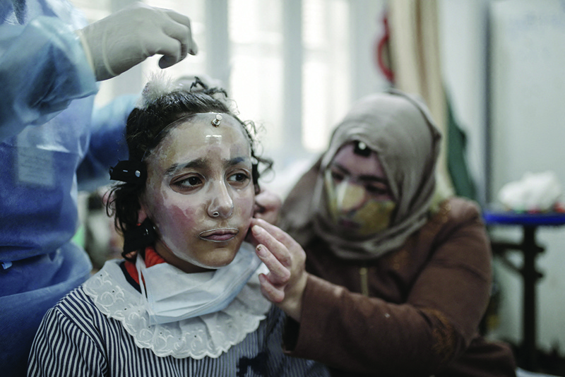 GAZA: Palestinian girl Maram and her mother Izdihar Al-Amawi get fitted with a 3D-printed transparent face mask at a clinic run by Doctors Without Borders in Gaza City on Feb 22, 2021. - AFP n
