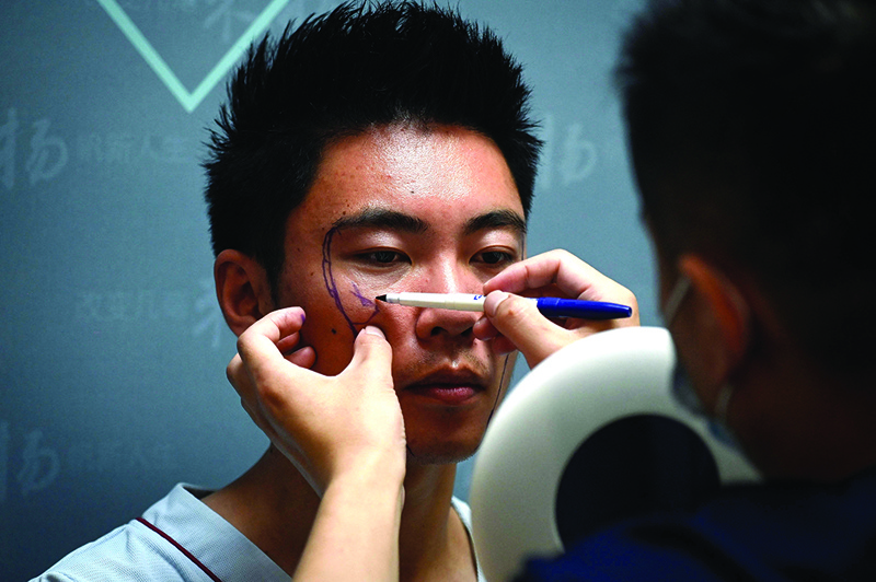 This picture shows a doctor marking scientific researcher Xia Shurong’s face before getting plastic surgery at a clinic in Beijing.—AFP photosn