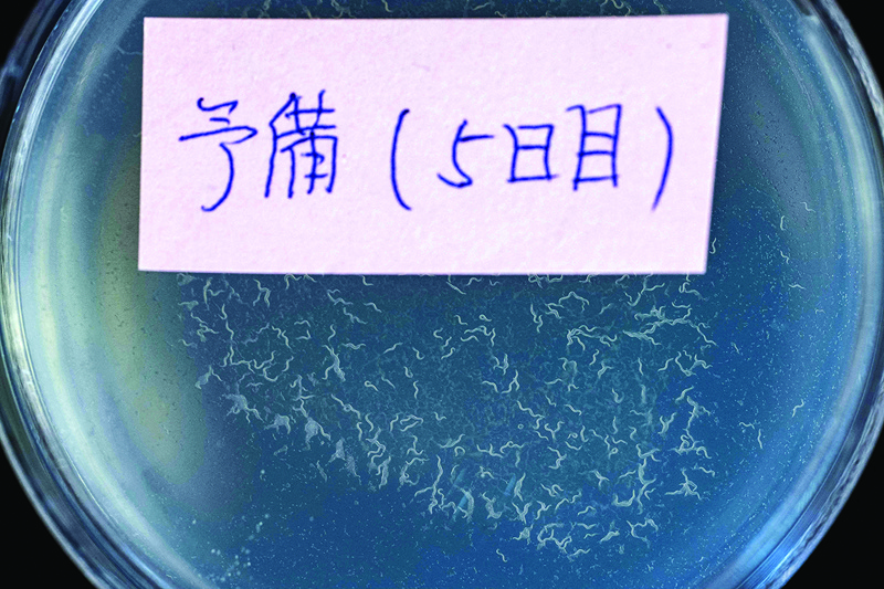 TOKYO: Tiny nematodes are seen in a petri dish during a press conference yesterday by Hirotsu Bio Science to introduce a cancer screening test. - AFPn