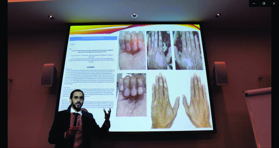 Dr Mohammad Al-Ansary gives a presentation about his patented vitiligo treatment.