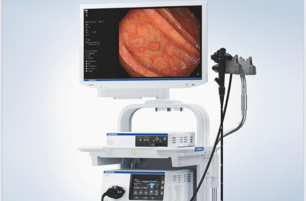 Jaber Hospital doctors perform Kuwait's first colonoscopy using artificial intelligence