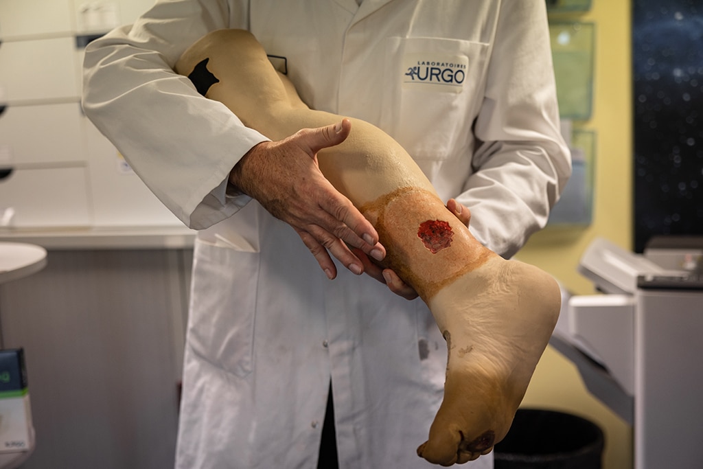 An Urgo employee shows the type of severe wounds that could be treated by the artificial skin developed by the French dressing manufacturer as part of the Genesis project at the Urgo site in Chenove, eastern France, on Dec 16, 2022. – AFP photos