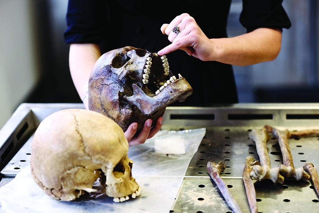 Belgian anthropologist Mathilde Daumas shows the skull of a soldier who fought in the Battle of Waterloo in 1815.